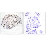 Immunohistochemistry - Anti-HDAC1 Antibody (B0793) - Antibodies.com