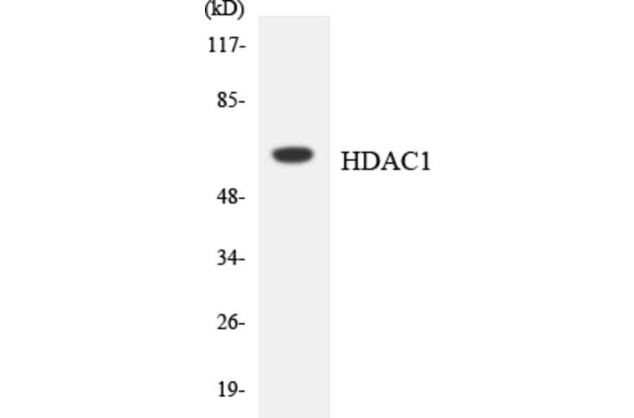 Western Blot - Anti-HDAC1 Antibody (R12-2869) - Antibodies.com