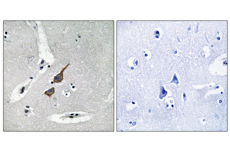 Immunohistochemistry - Anti-GRID1 Antibody (C12394) - Antibodies.com