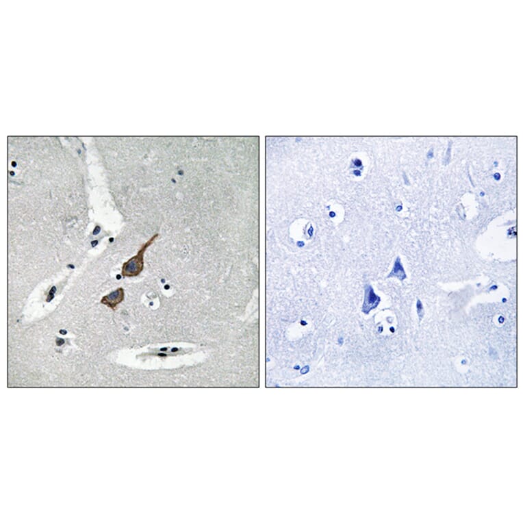 Immunohistochemistry - Anti-GRID1 Antibody (C12394) - Antibodies.com