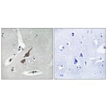 Immunohistochemistry - Anti-GRID1 Antibody (C12394) - Antibodies.com