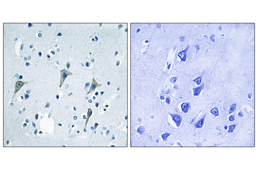 Immunohistochemistry - Anti-GPR85 Antibody (G357) - Antibodies.com