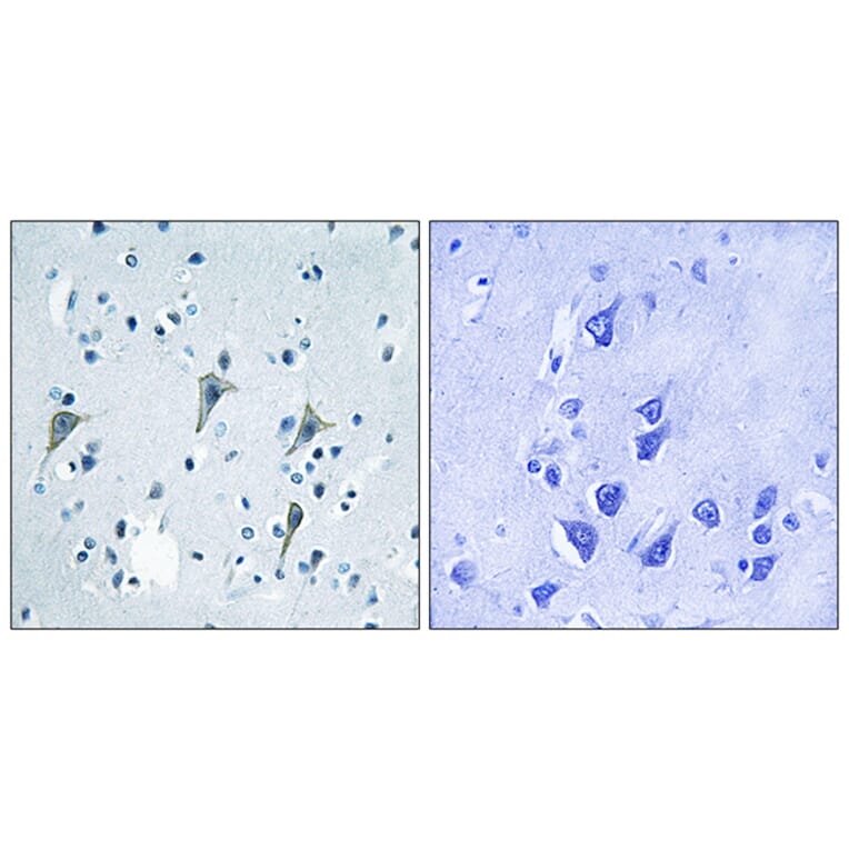 Immunohistochemistry - Anti-GPR85 Antibody (G357) - Antibodies.com