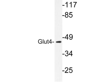 Western Blot - Anti-Glut4 Antibody (R12-2166) - Antibodies.com