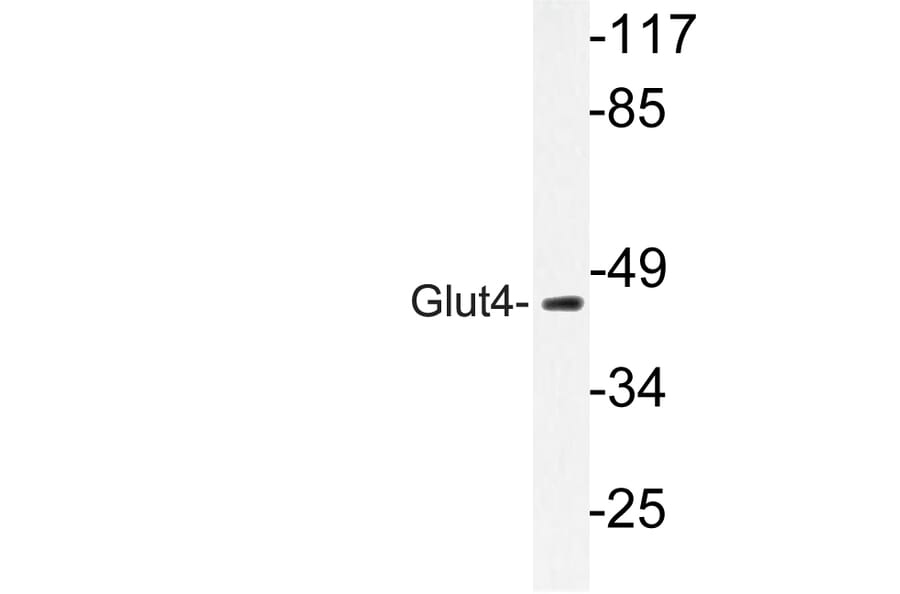 Western Blot - Anti-Glut4 Antibody (R12-2166) - Antibodies.com