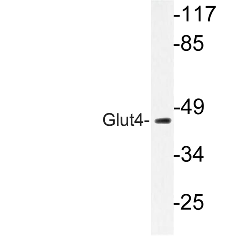 Western Blot - Anti-Glut4 Antibody (R12-2166) - Antibodies.com