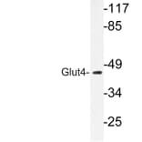 Western Blot - Anti-Glut4 Antibody (R12-2166) - Antibodies.com