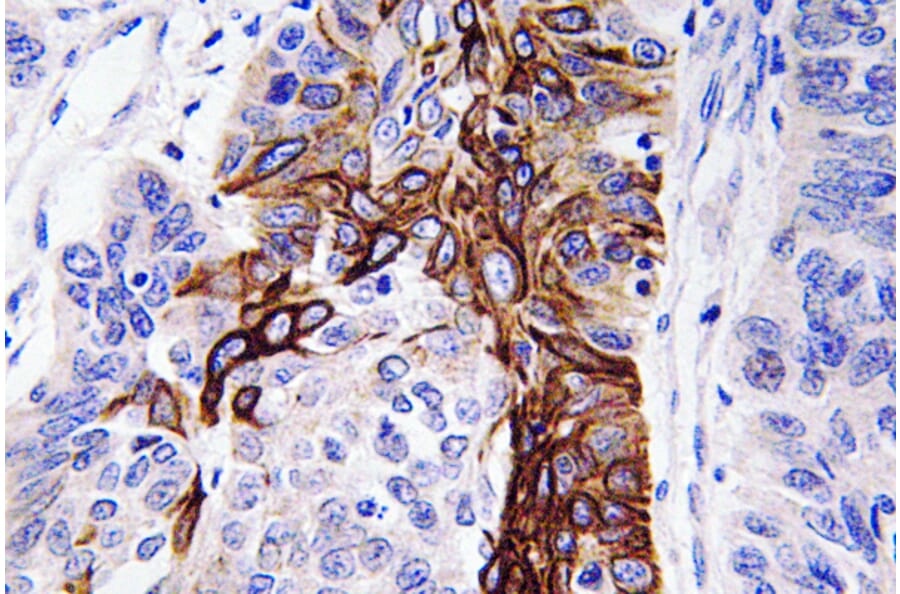 Immunohistochemistry - Anti-Glut4 Antibody (R12-2166) - Antibodies.com