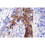 Immunohistochemistry - Anti-Glut4 Antibody (R12-2166) - Antibodies.com
