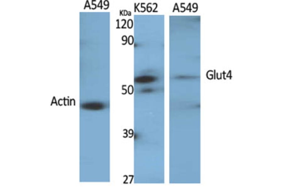 Western Blot - Anti-Glut4 Antibody (R12-2166) - Antibodies.com