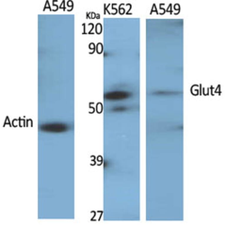 Western Blot - Anti-Glut4 Antibody (R12-2166) - Antibodies.com