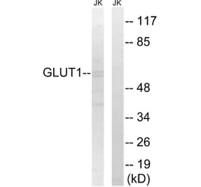 Western Blot - Anti-GLUT1 Antibody (C0213) - Antibodies.com