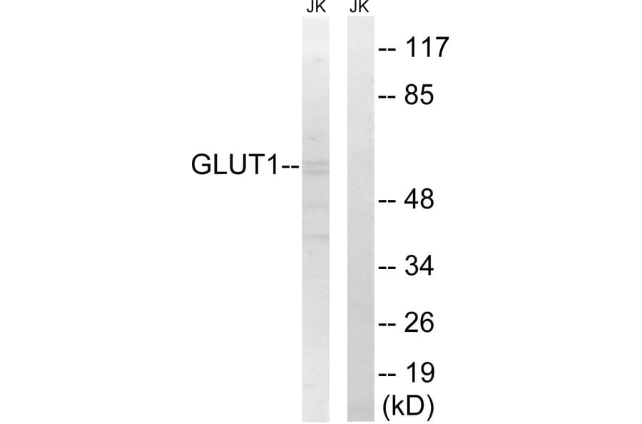 Western Blot - Anti-GLUT1 Antibody (C0213) - Antibodies.com