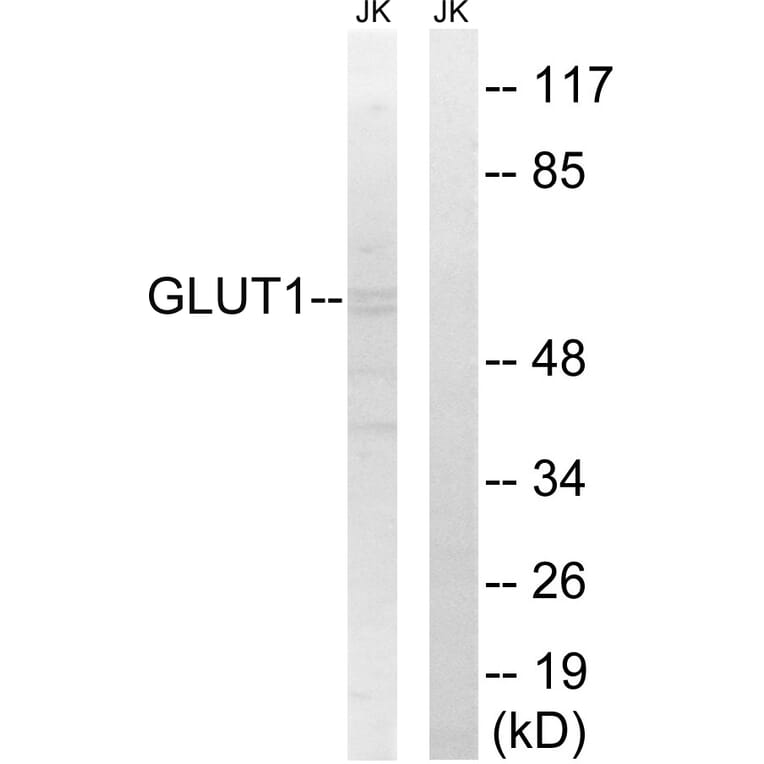 Western Blot - Anti-GLUT1 Antibody (C0213) - Antibodies.com