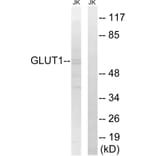 Western Blot - Anti-GLUT1 Antibody (C0213) - Antibodies.com