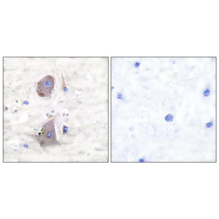 Immunohistochemistry - Anti-GLUT1 Antibody (C0213) - Antibodies.com