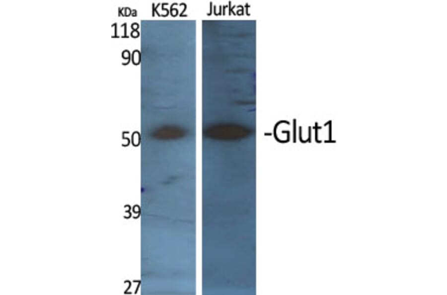 Western Blot - Anti-GLUT1 Antibody (C0213) - Antibodies.com