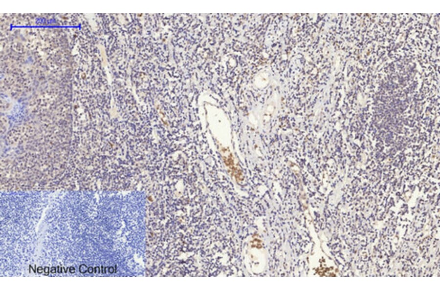 Immunohistochemistry - Anti-GLUT1 Antibody (C0213) - Antibodies.com