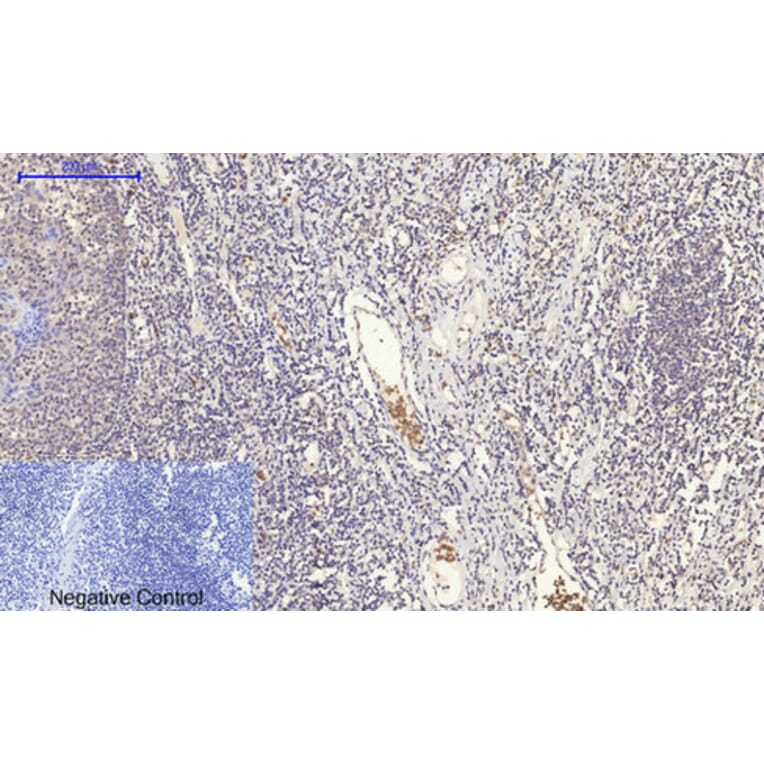 Immunohistochemistry - Anti-GLUT1 Antibody (C0213) - Antibodies.com