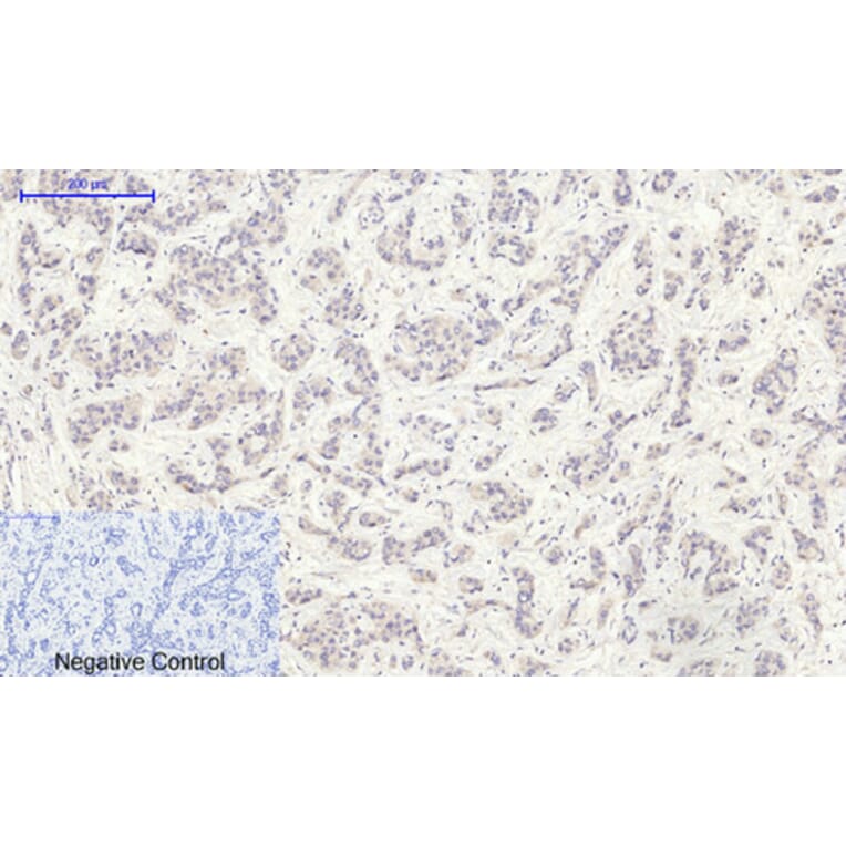 Immunohistochemistry - Anti-GLUT1 Antibody (C0213) - Antibodies.com