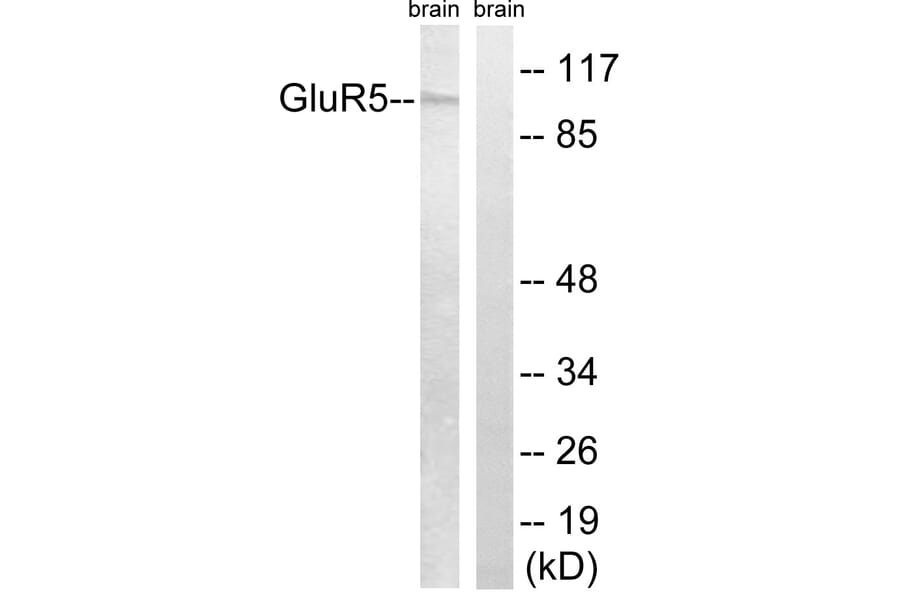 Western Blot - Anti-GluR5 Antibody (C0209) - Antibodies.com