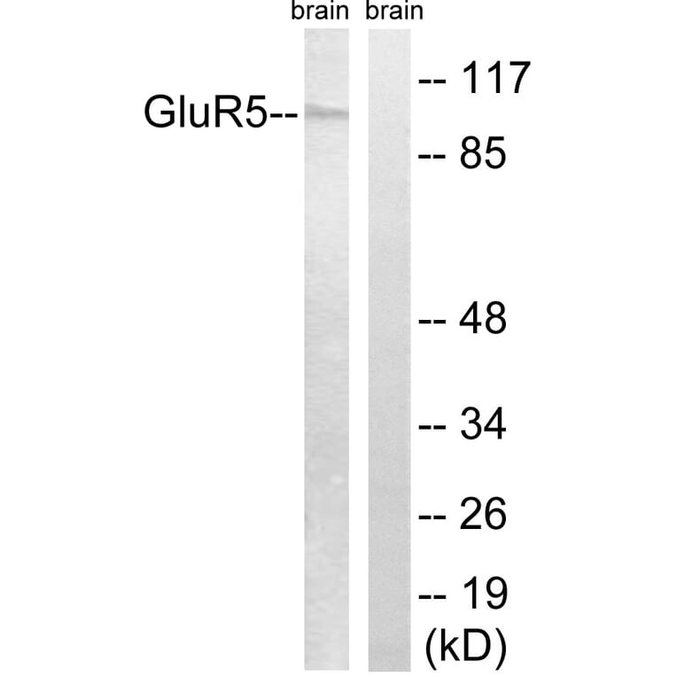 Western Blot - Anti-GluR5 Antibody (C0209) - Antibodies.com