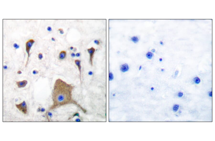 Immunohistochemistry - Anti-GluR5 Antibody (C0209) - Antibodies.com