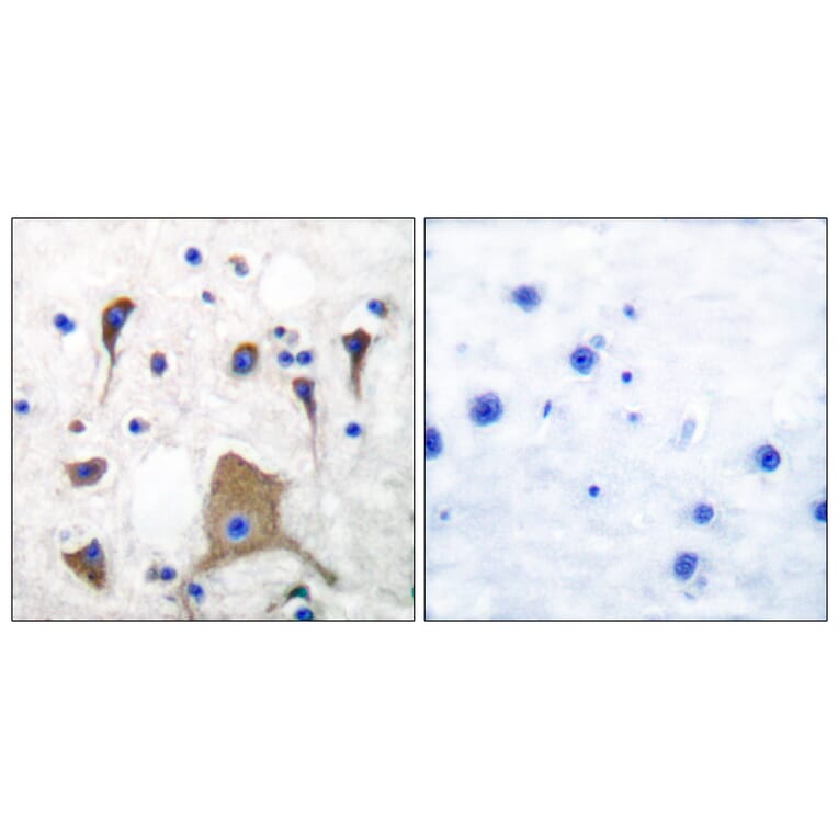 Immunohistochemistry - Anti-GluR5 Antibody (C0209) - Antibodies.com