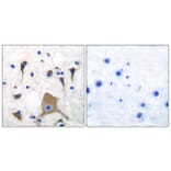 Immunohistochemistry - Anti-GluR5 Antibody (C0209) - Antibodies.com