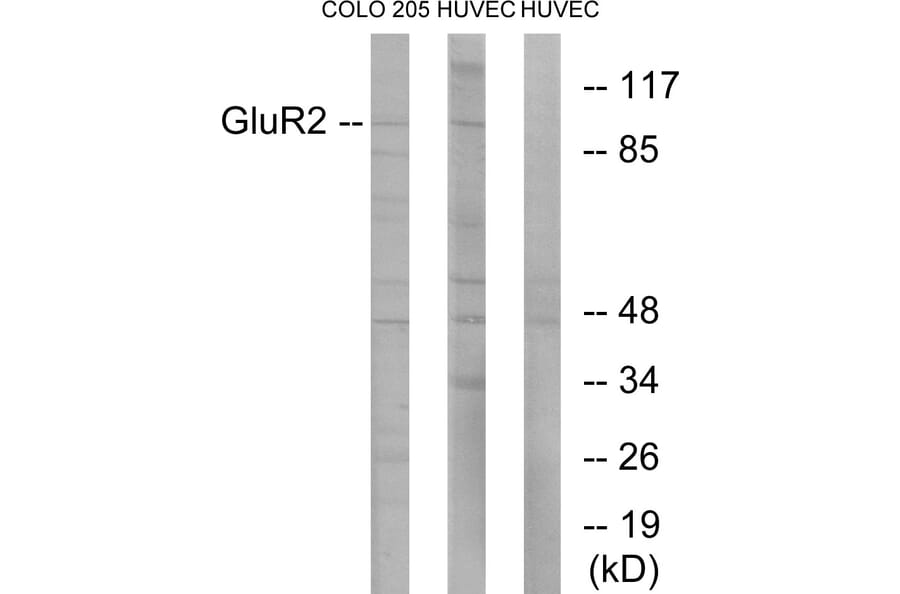 Western Blot - Anti-GluR2 Antibody (B7096) - Antibodies.com
