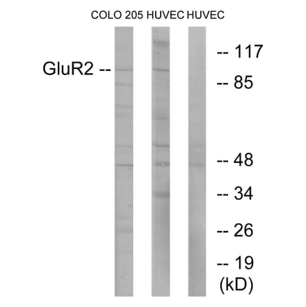 Western Blot - Anti-GluR2 Antibody (B7096) - Antibodies.com