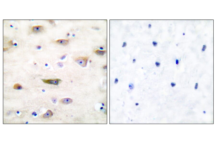 Immunohistochemistry - Anti-GluR2 Antibody (B7096) - Antibodies.com