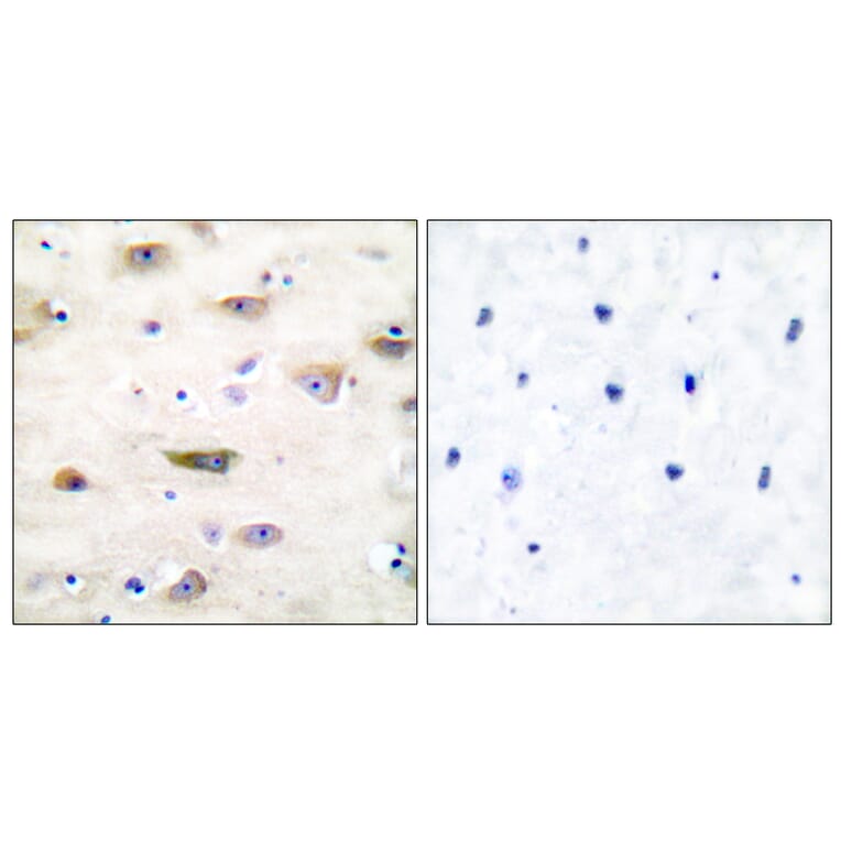 Immunohistochemistry - Anti-GluR2 Antibody (B7096) - Antibodies.com