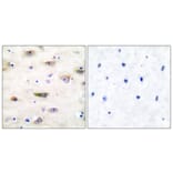 Immunohistochemistry - Anti-GluR2 Antibody (B7096) - Antibodies.com
