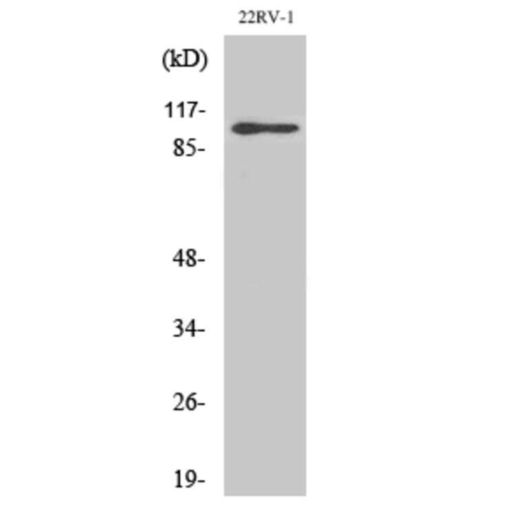 Western Blot - Anti-GluR2 Antibody (B7096) - Antibodies.com