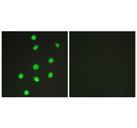 Immunofluorescence - Anti-GLI-3 Antibody (C10328) - Antibodies.com