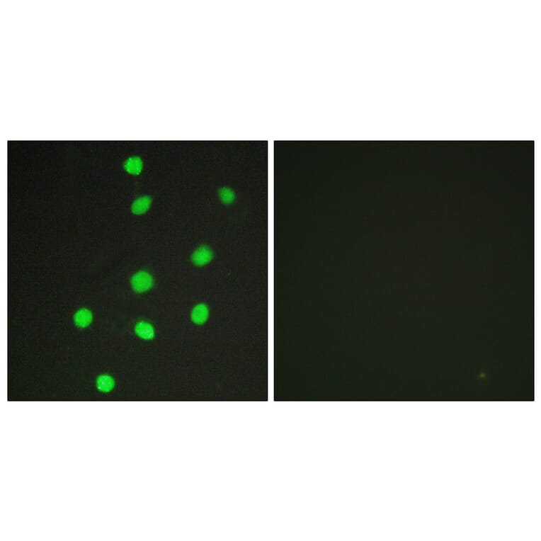 Immunofluorescence - Anti-GLI-3 Antibody (C10328) - Antibodies.com