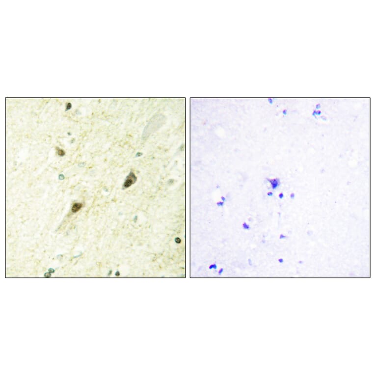 Immunohistochemistry - Anti-GLI-3 Antibody (C10328) - Antibodies.com