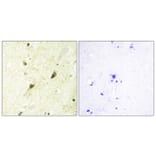 Immunohistochemistry - Anti-GLI-3 Antibody (C10328) - Antibodies.com