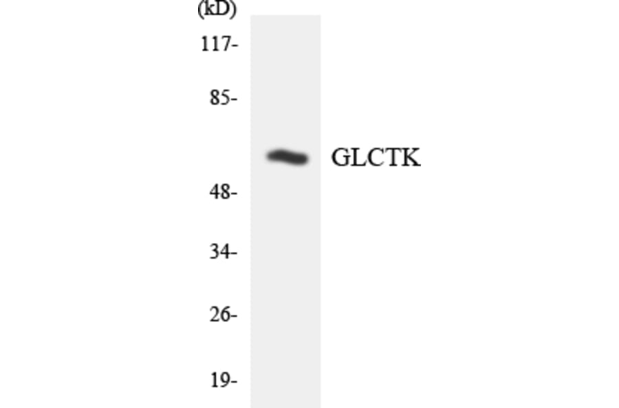 Western Blot - Anti-GLCTK Antibody (R12-2815) - Antibodies.com