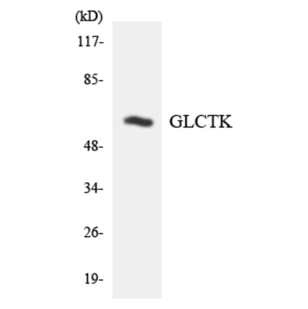 Western Blot - Anti-GLCTK Antibody (R12-2815) - Antibodies.com