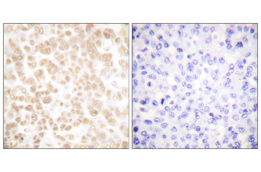Immunohistochemistry - Anti-Fra-2 Antibody (C0197) - Antibodies.com