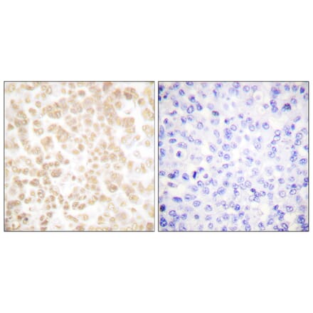 Immunohistochemistry - Anti-Fra-2 Antibody (C0197) - Antibodies.com