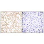 Immunohistochemistry - Anti-Fra-2 Antibody (C0197) - Antibodies.com