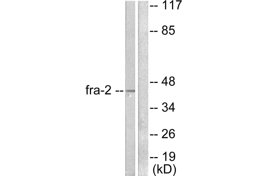 Western Blot - Anti-Fra-2 Antibody (C0197) - Antibodies.com