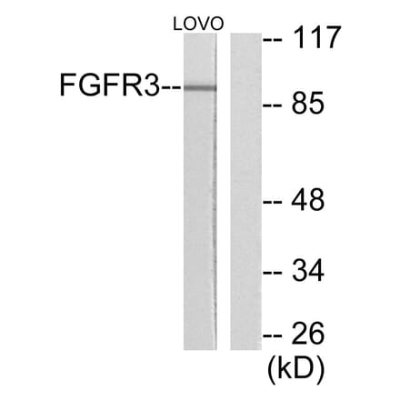 Western Blot - Anti-FGFR3 Antibody (C0192) - Antibodies.com
