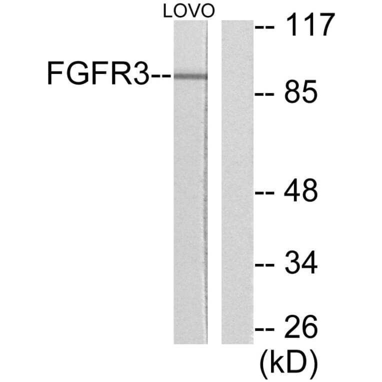 Western Blot - Anti-FGFR3 Antibody (C0192) - Antibodies.com