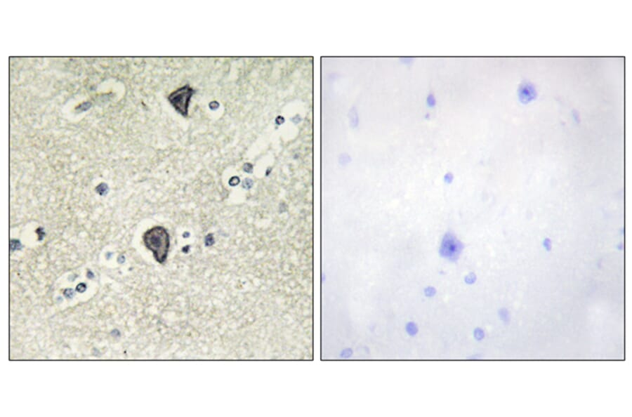 Immunohistochemistry - Anti-FGFR3 Antibody (C0192) - Antibodies.com