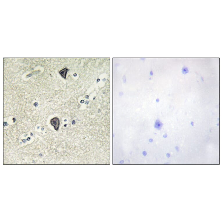 Immunohistochemistry - Anti-FGFR3 Antibody (C0192) - Antibodies.com