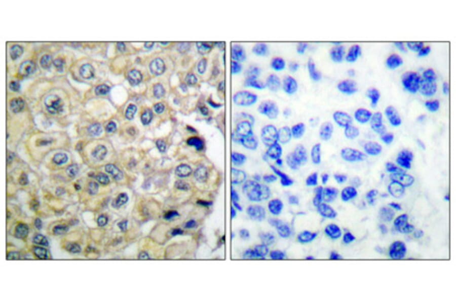 Immunohistochemistry - Anti-FGFR3 Antibody (C0192) - Antibodies.com
